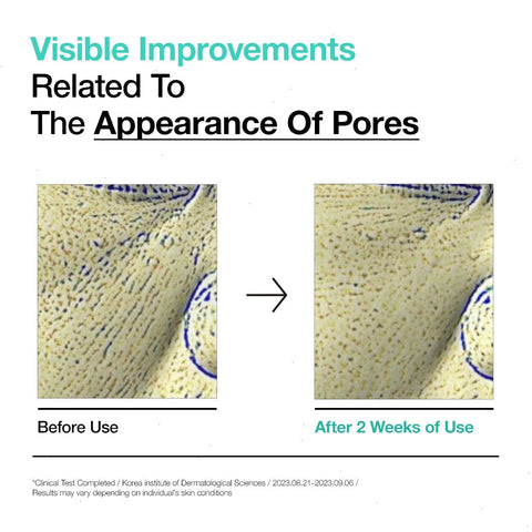 BHA 2% Gentle Exfoliating Toner