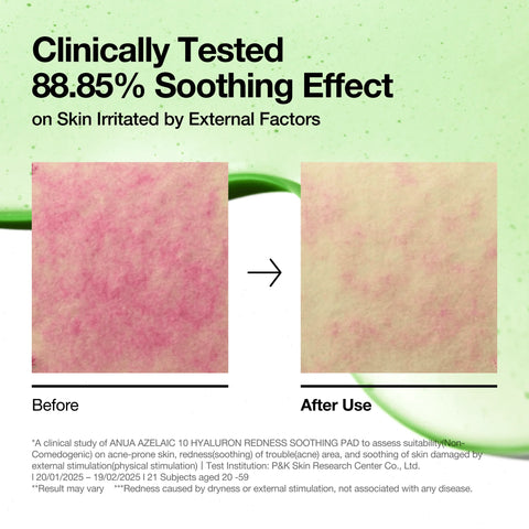 Azelaic 10 Hyaluron Redness Soothing Pad