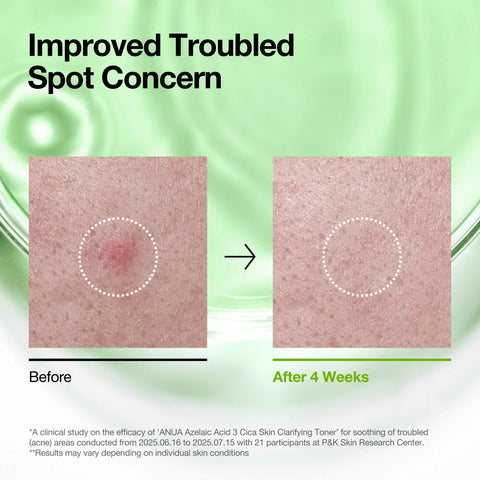 Azelaic 3 Cica Skin Clarifying Toner